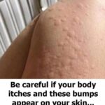 Signs of Arthritis You Shouldn’t Ignore