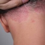 Discovered this red patch on my grandson and everyone is freaking out. What is it and what should we do?