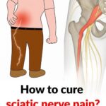 3 exercises to relieve sciatica pain in the leg: practical and effective