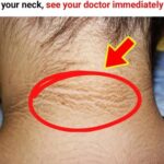 If You Notice a Dark Ring Around Your Neck, Go See Your Doctor Immediately! This Is What It Means