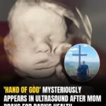 After praying for her baby’s well-being, mom spots ‘Hand of God’ in ultrasound